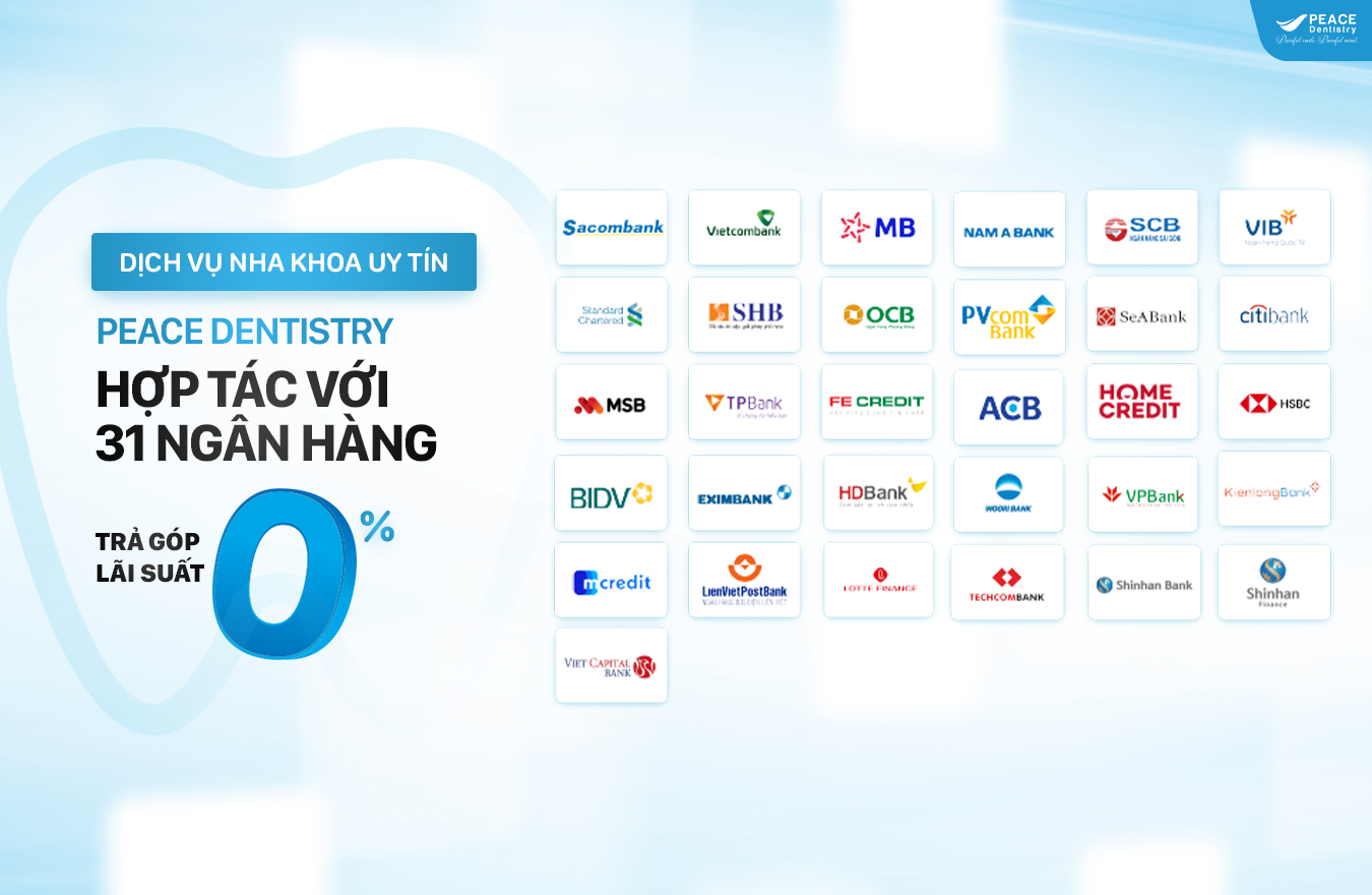 chi phí niềng răng thanh toán trả góp
