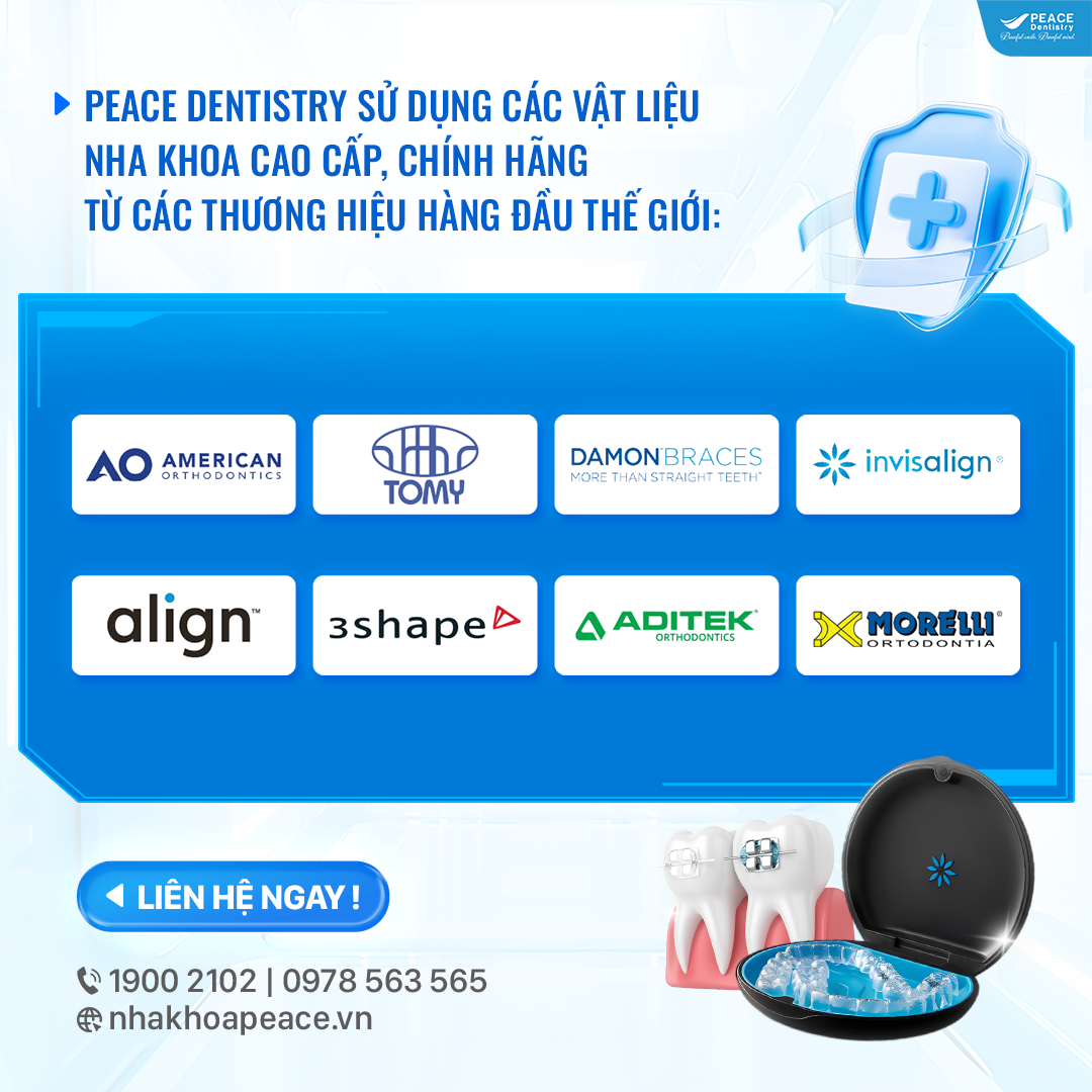 vật liệu niềng răng chính hãng