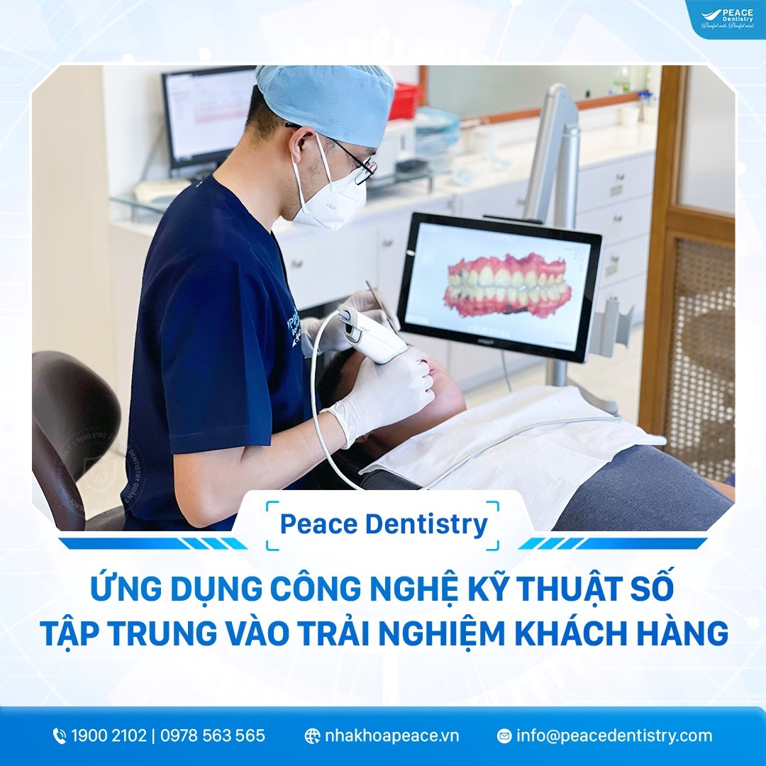 trình độ bác sĩ ảnh hưởng đến thời gian niềng răng hô
